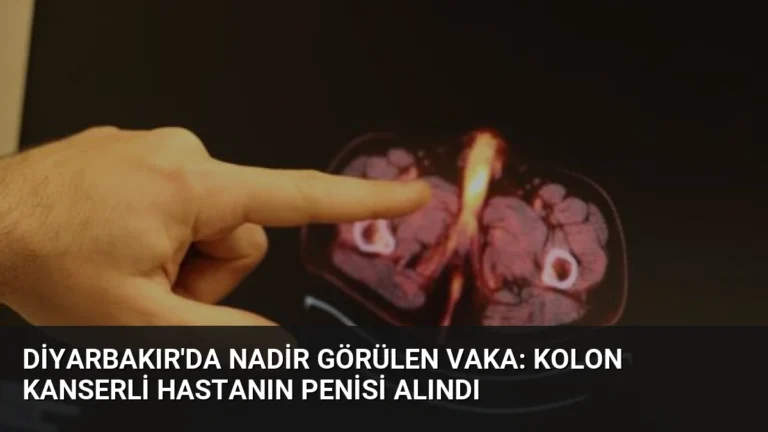 Diyarbakır’da Nadir Görülen Vaka: Kolon Kanserli Hastanın Penisi Alındı