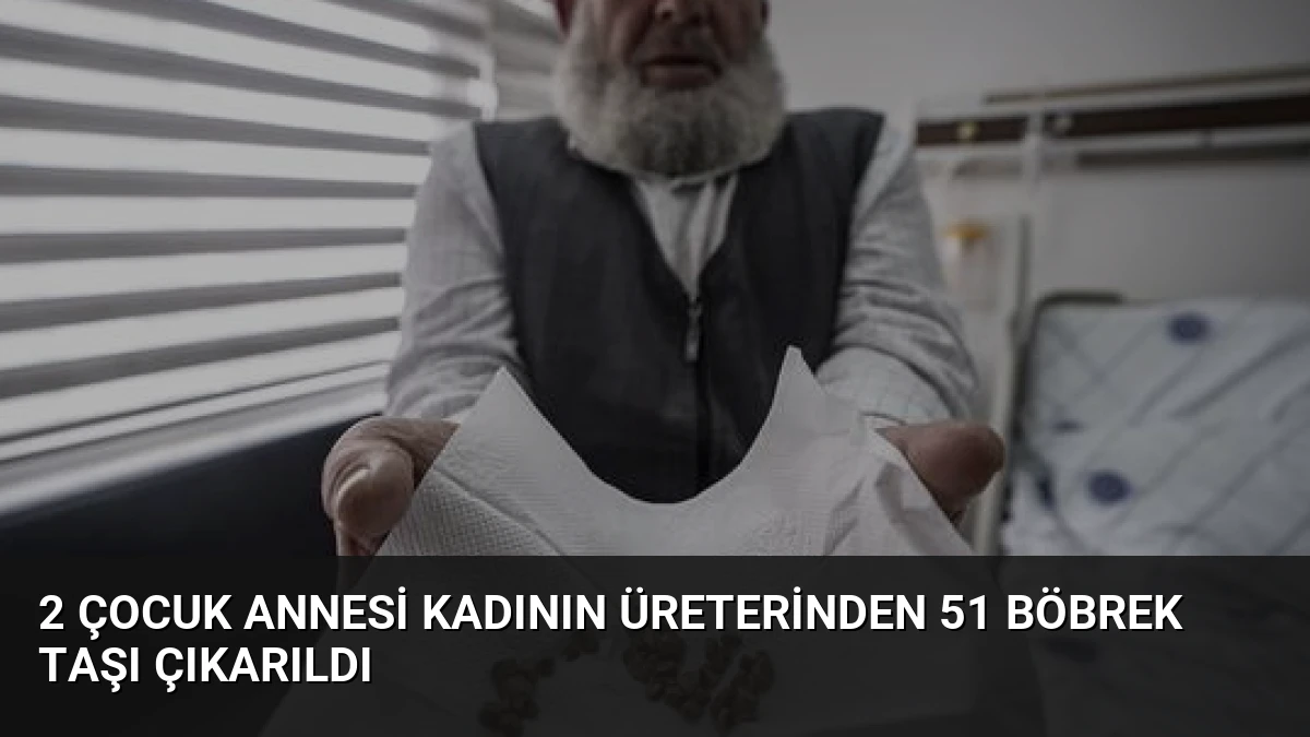 2 Çocuk Annesi Kadının Üreterinden 51 Böbrek Taşı Çıkarıldı