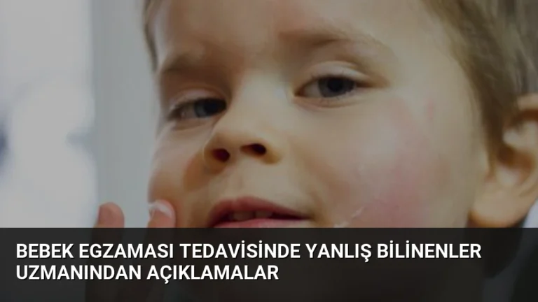 Bebek Egzaması Tedavisinde Yanlış Bilinenler Uzmanından Açıklamalar