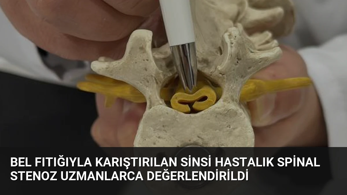 Bel Fıtığıyla Karıştırılan Sinsi Hastalık Spinal Stenoz Uzmanlarca Değerlendirildi