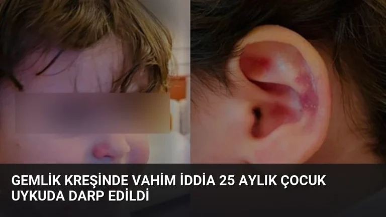 Gemlik Kreşinde Vahim İddia 25 Aylık Çocuk Uykuda Darp Edildi
