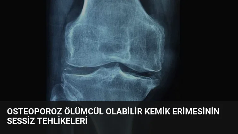 Osteoporoz Ölümcül Olabilir Kemik Erimesinin Sessiz Tehlikeleri