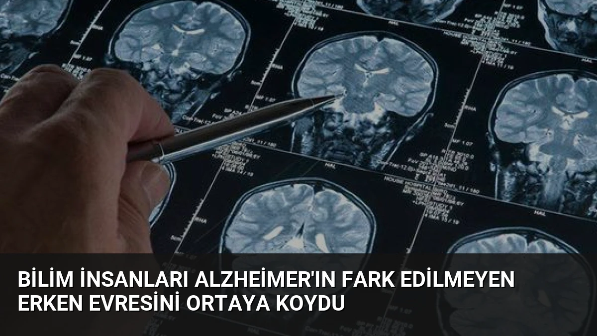 Bilim İnsanları Alzheimer’ın Fark Edilmeyen Erken Evresini Ortaya Koydu