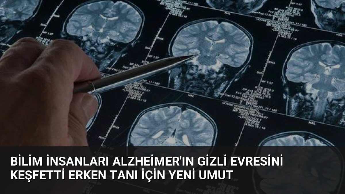 Bilim İnsanları Alzheimer’ın Gizli Evresini Keşfetti Erken Tanı İçin Yeni Umut