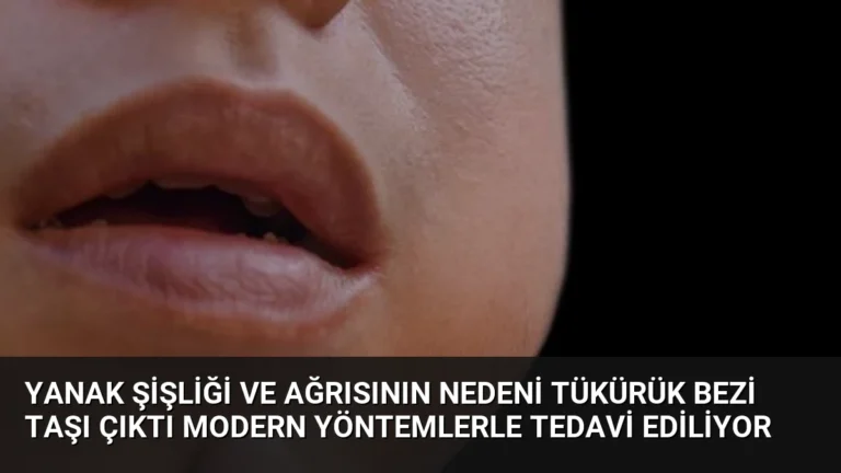 Yanak Şişliği ve Ağrısının Nedeni Tükürük Bezi Taşı Çıktı Modern Yöntemlerle Tedavi Ediliyor